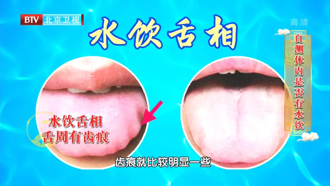 濕邪不除,損害心臟! 每天睡前這樣泡腳,護心安神,全身都輕鬆