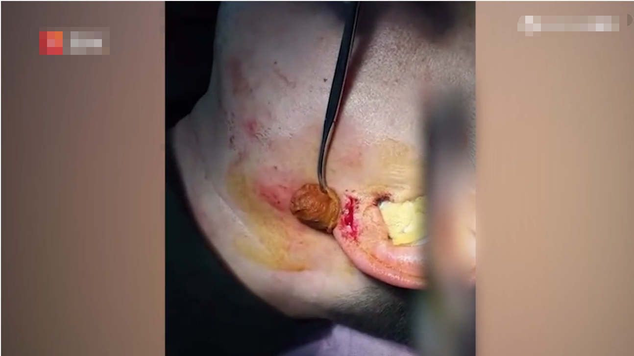 西安男子质疑物业费不合理，要合同被按地踹头