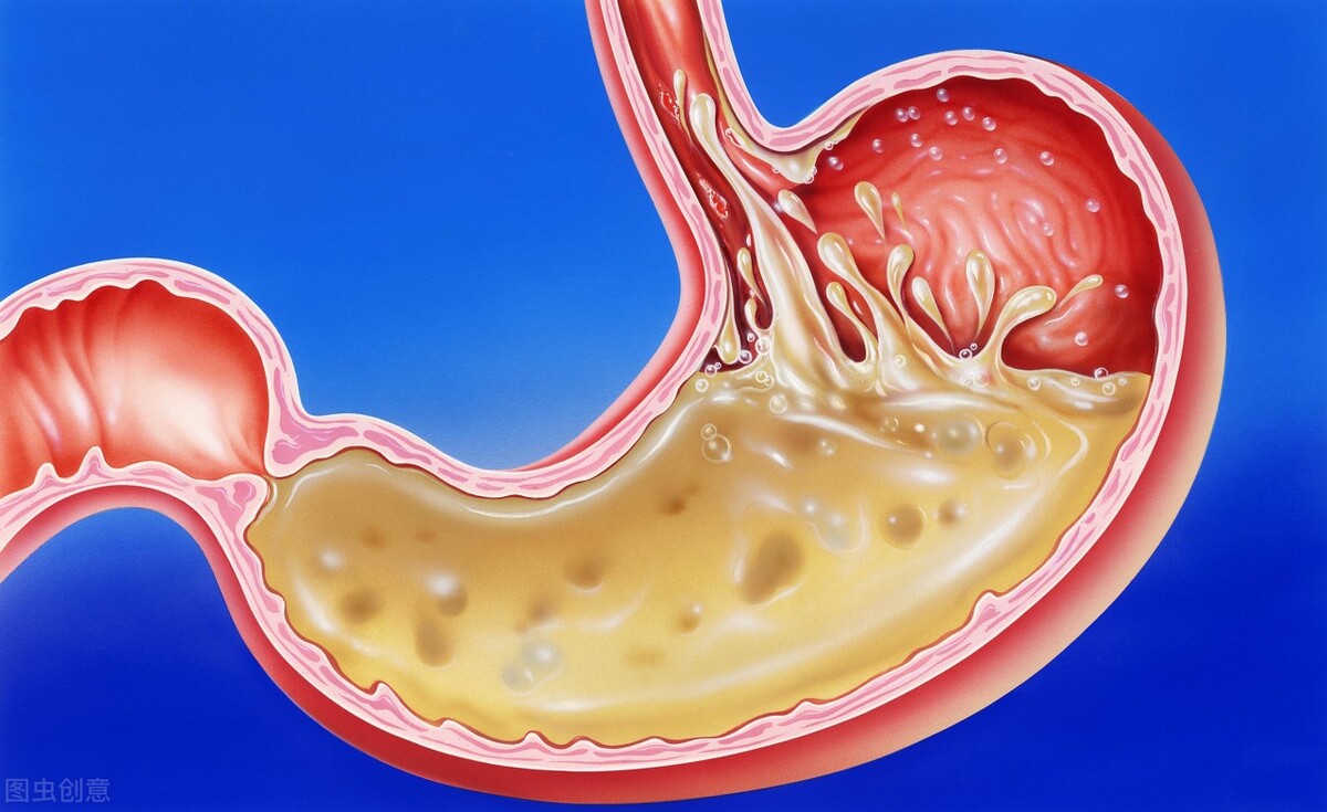 患乙肝卻傷的是胃粘膜？ 它是從這4方面來“搗蛋”的，做好2點養胃