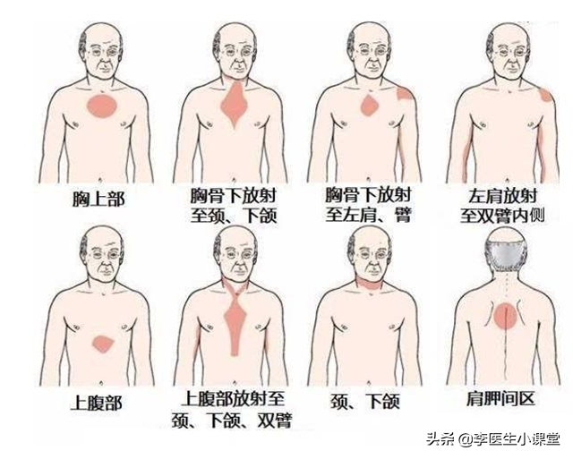 “速效救心丸”和“硝酸甘油”，谁才能紧急救命？吃错反而更伤身