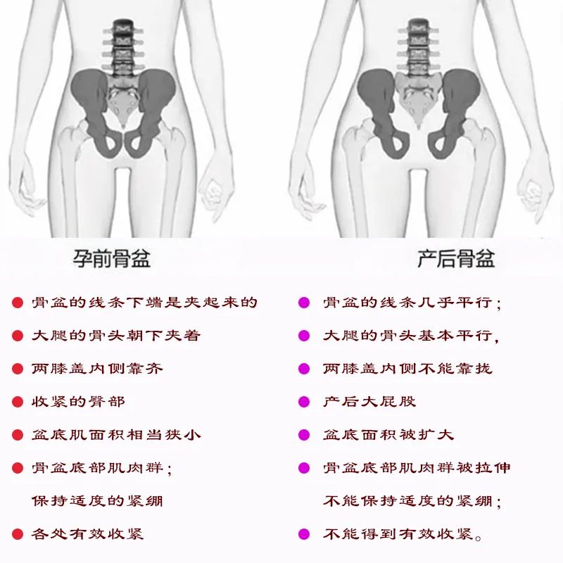 骨盆修復(fù) | 打響骨盆保衛(wèi)戰(zhàn)！重塑女人青春源