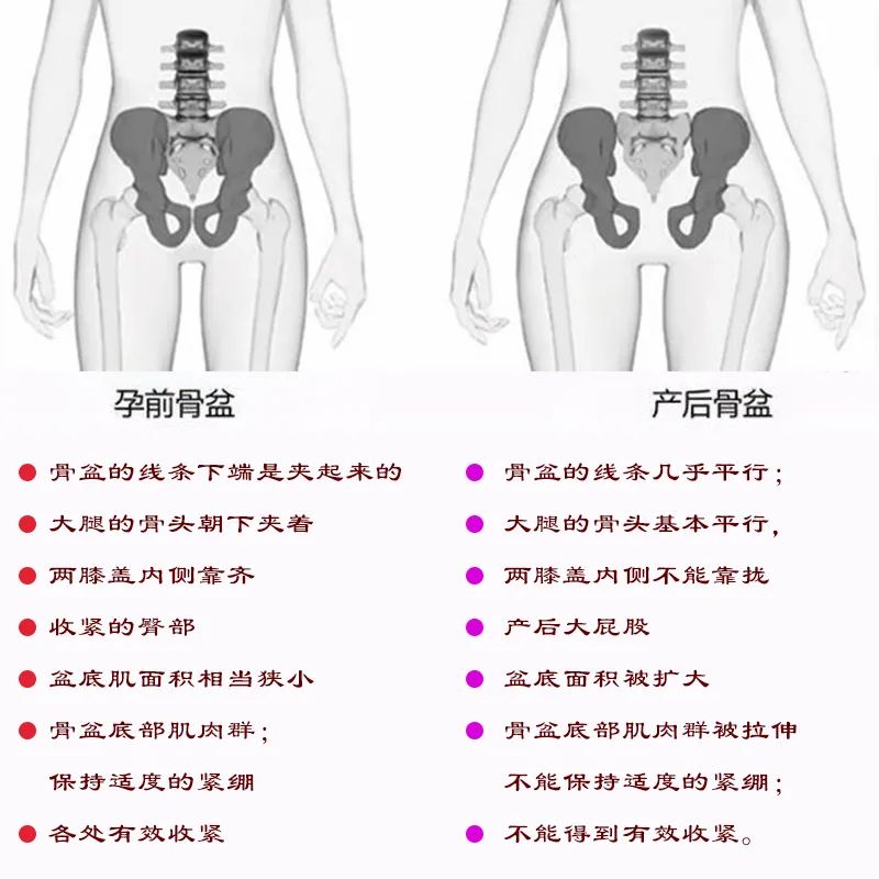 骨盆修复 | 打响骨盆保卫战！重塑女人青春源