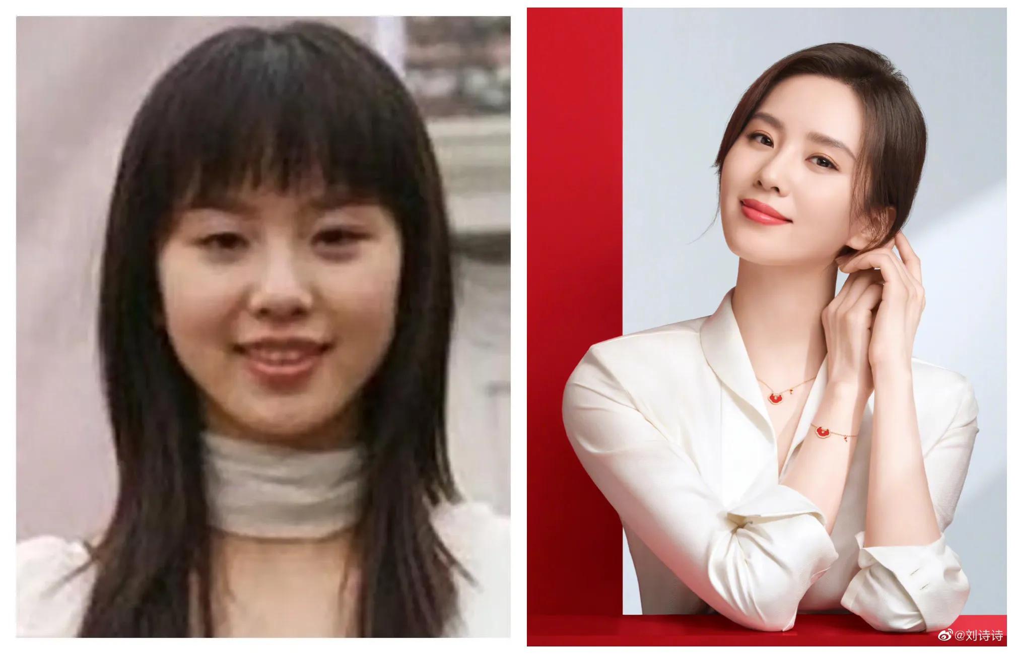 五大女明星出道前后对比，疑似整容，到底哪位
