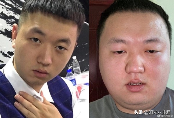 Net merbromin elder brother grow stout is serious! Take a picture oneself steamed bread of just like leaven dough, netizen proposal is incognito call affusion elder brother