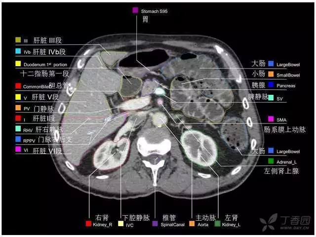 掌握这篇解剖，晋级腹部CT影像诊断高手（精细版）