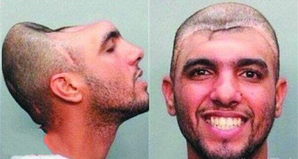 原本只是涉嫌教唆卖淫，却因具有独特生理特征而红遍全球