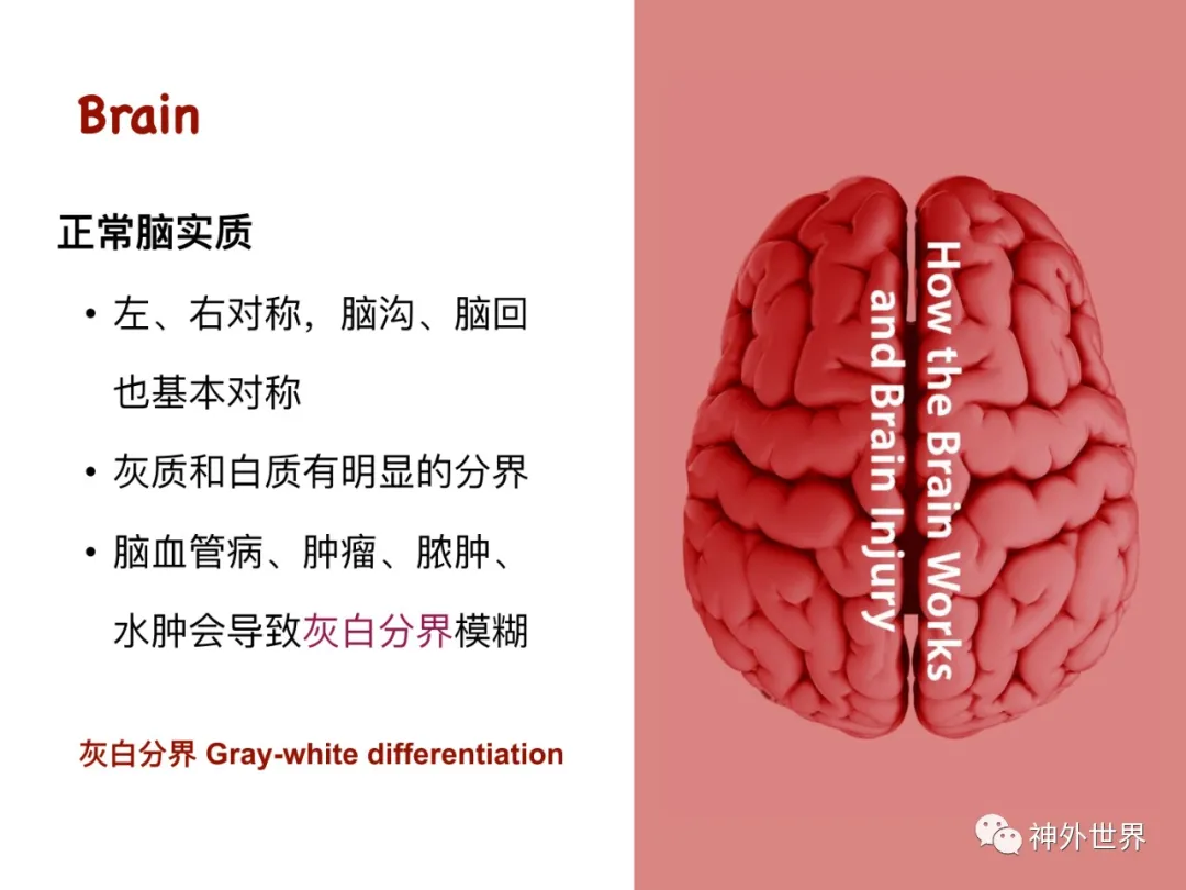 最全影像总结 | 颅内病变 MR、CT 的阅片技巧，太赞了