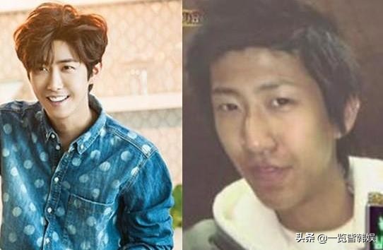 黄光熙公开整容苦衷 狂怼李孝利艺能感爆棚 自嘲