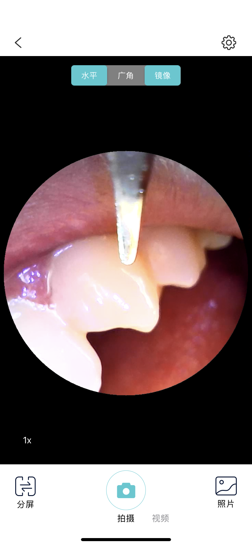 谁说牙齿不能做SPA-素诺智能可视超声波洁牙仪体验