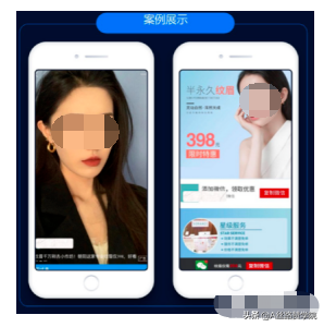 医美行业腾讯广告投放见解