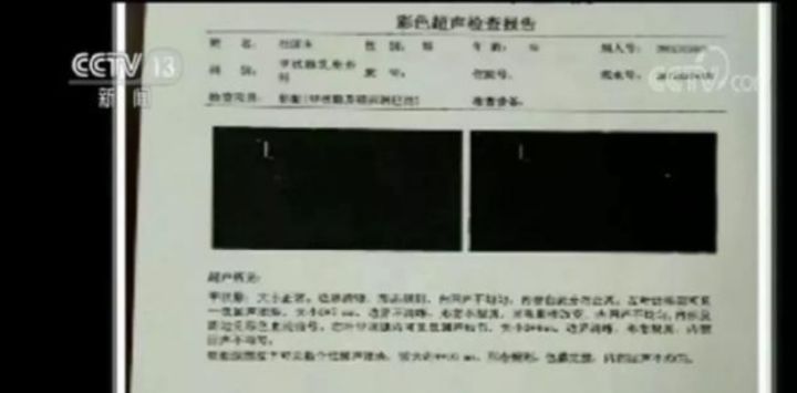 在看过上百个拒赔案例后，我终于知道为什么说保险公司是骗人的了 第4张