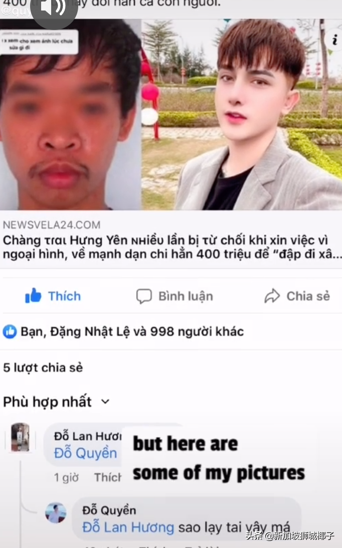 9次整容后，越南小伙“换头”成百万粉丝的网红！值得吗？