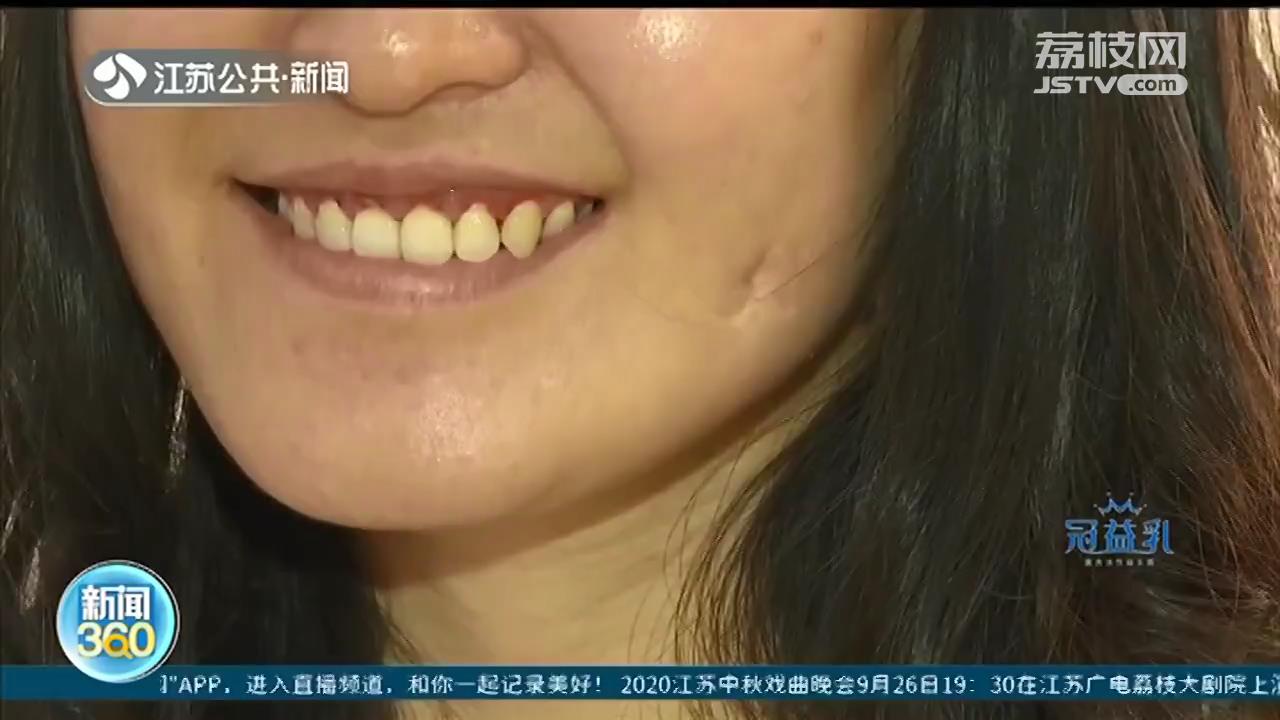 两边脸不对称，罕见半侧颜面短小症 南京女子20年两次手术盼“蜕变”