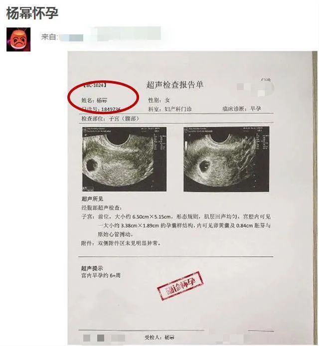 郑爽代孕众女星被牵连，杨幂杨颖孕照被扒，张雨绮龙凤胎遭质疑