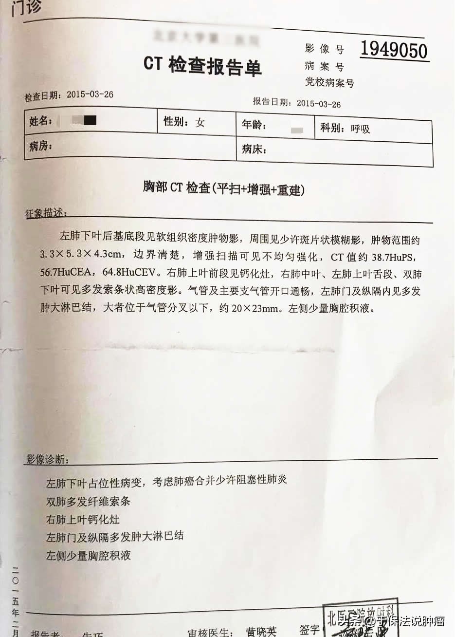 左肺下叶肿瘤，经缓释库超微创靶向治疗，生存超过6年