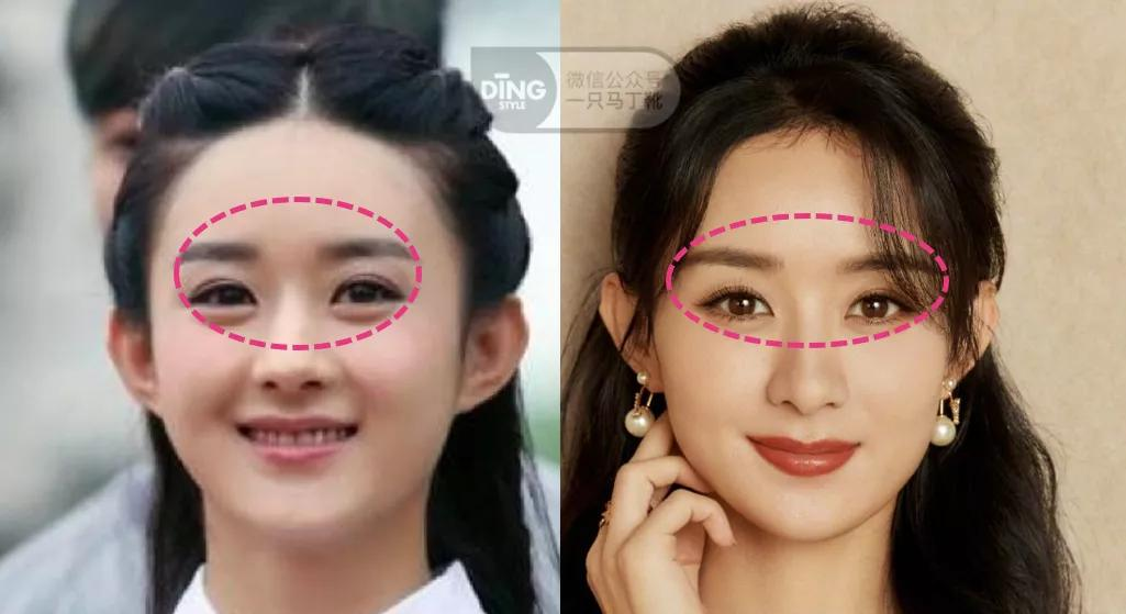 脸肉脸圆的女生,怎样全方位实现颜值进阶?|