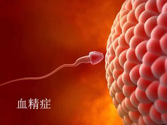 周强医生「男性健康知识科普」血精知多少？射J出血是怎么回事？