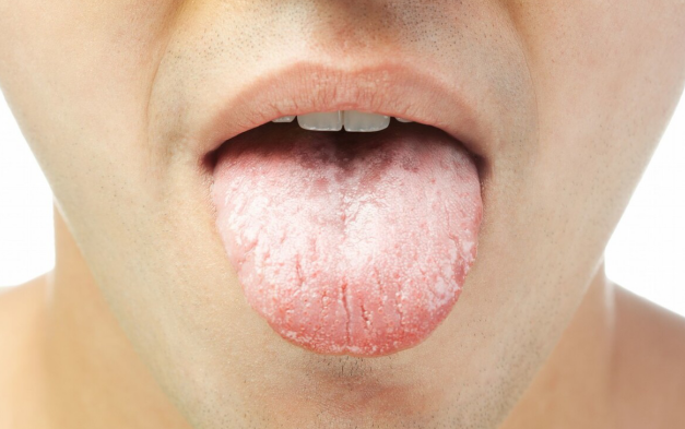 胃裡有幽門螺桿菌，嘴巴通常會發出3個信號，醫生：趁早檢查一下