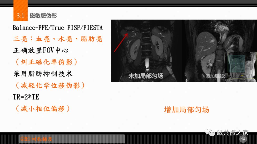 磁共振常见伪影及策略