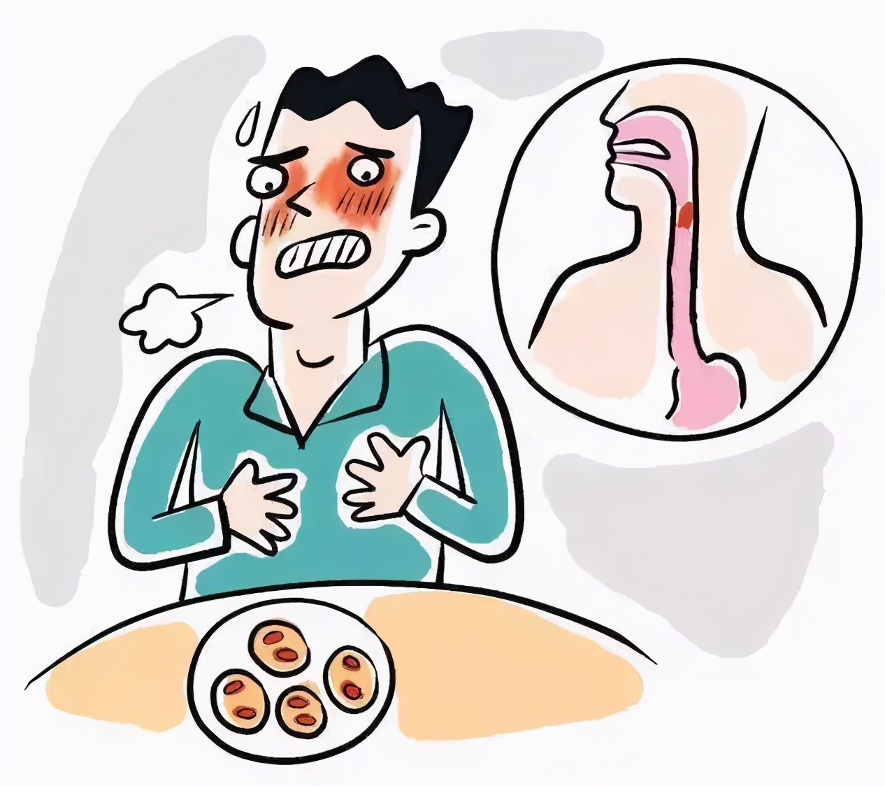 食管罢工美食无法下咽怎么办胸外科医生还你舌尖美味