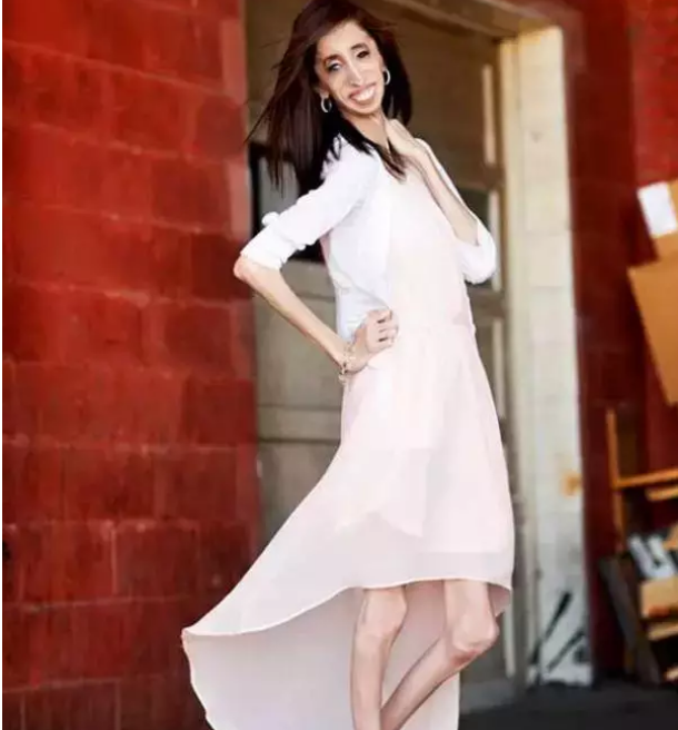 网红\"零脂肪女孩\"，曾经被人恶言相向，