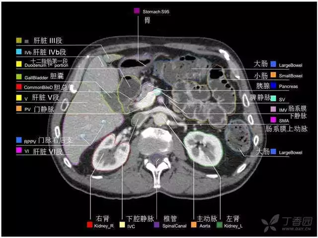 掌握这篇解剖，晋级腹部CT影像诊断高手（精细版）
