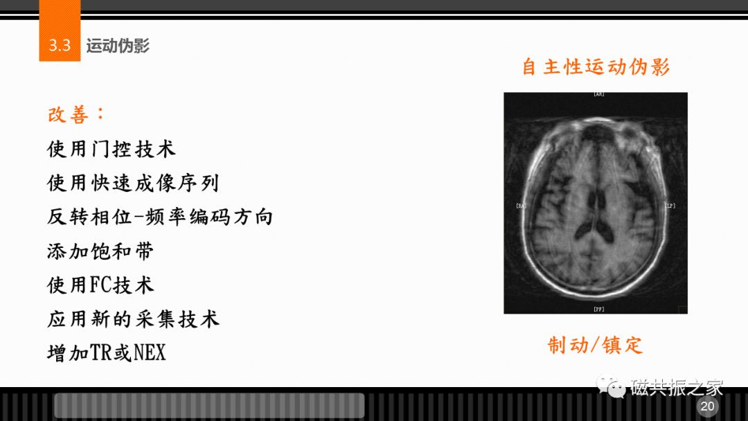 磁共振常见伪影及策略