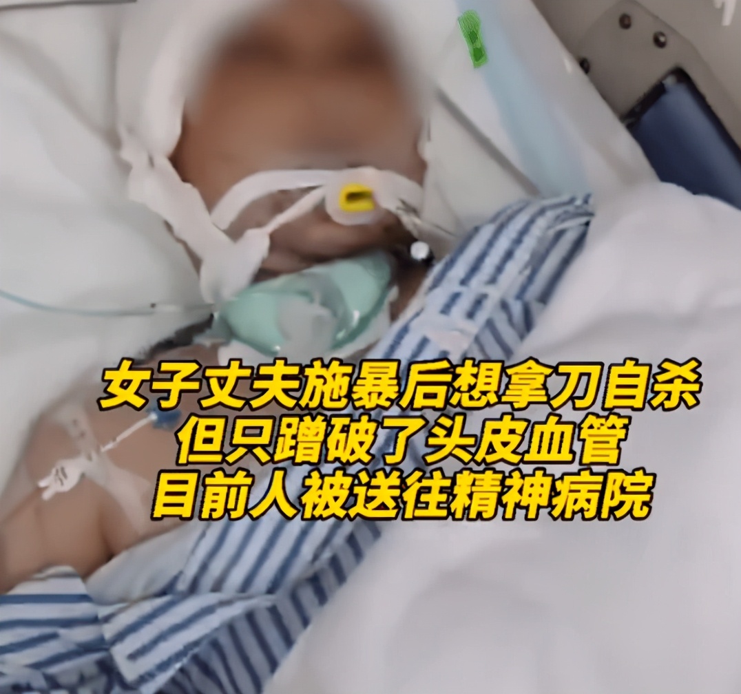 女子遭家暴，頭骨開(kāi)裂昏迷63天！中年婚姻全憑良心！遠(yuǎn)離這3種人