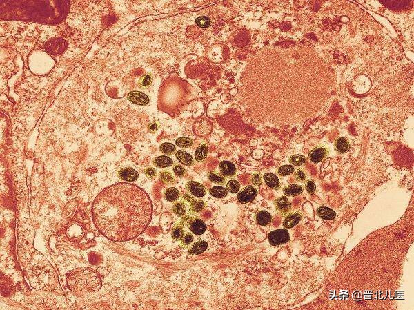 农乐生物 疫情来袭,来了解一下微生物!
