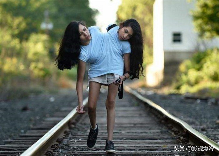 “最奇特的双胞胎”，一个死了另一个会怎样？