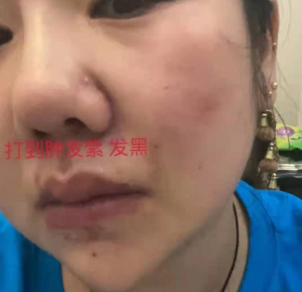 800万粉网红被控家暴，妻子晒多张照片肋骨被打断，孩子跪地求饶