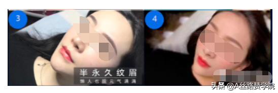 医美行业腾讯广告投放见解