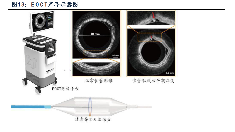 南微医学专题研究：另辟蹊径，成就消化内镜领军企业
