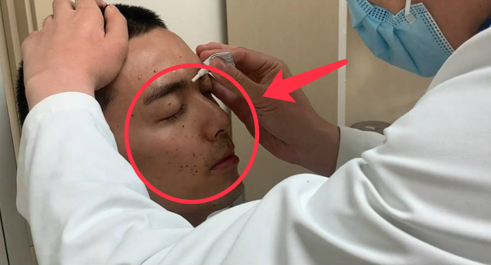 太心疼！吴磊拍戏炸伤脸，脸上全是伤口，他却坚持拍完才就医