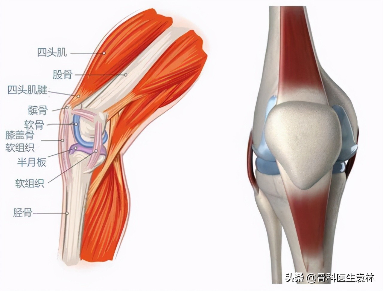 膝关节软骨损伤怎么治疗才能恢复正常 膝盖软骨磨没了怎么办 膝关节损伤