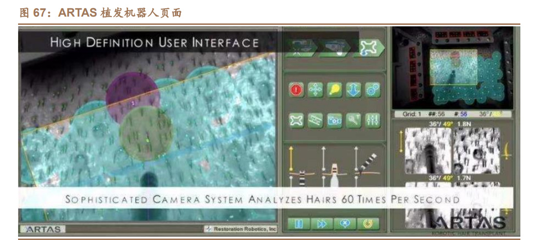 植发行业深度研究报告：从雍禾IPO看植发产业大发展