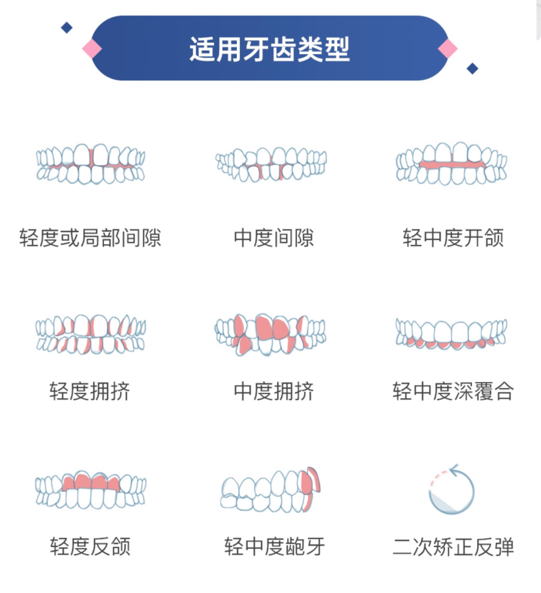 張雨綺新戀情曝光：“這次她看男人的眼光終于好了！”