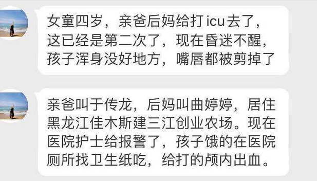 令人发指！这个恶魔后妈，剪开了4岁女孩的嘴唇