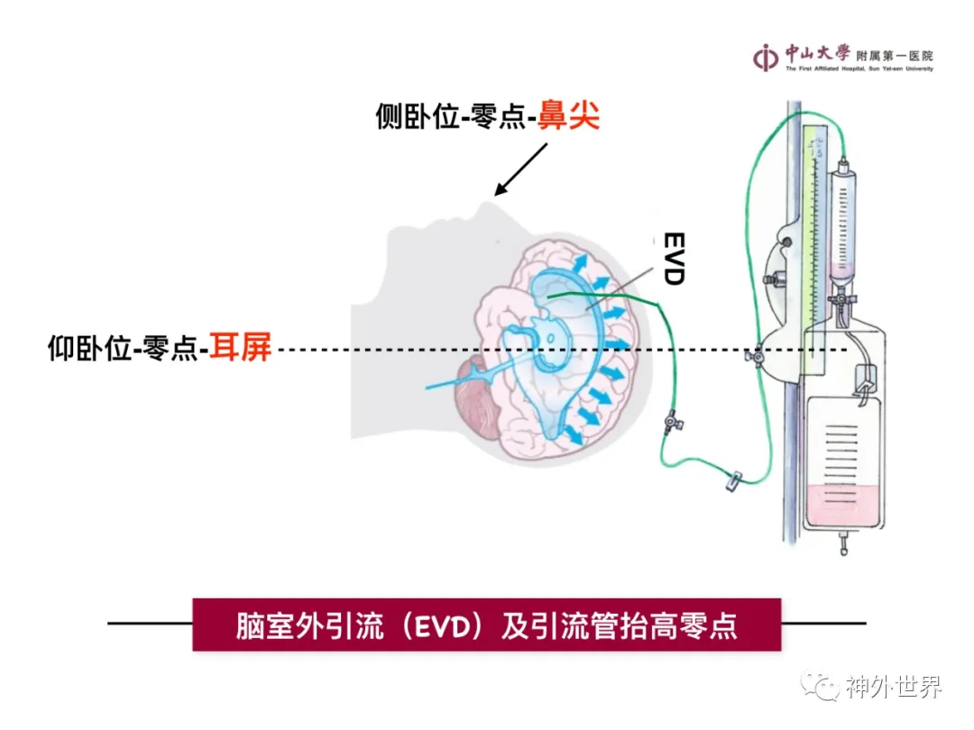 最全影像总结 | 颅内病变 MR、CT 的阅片技巧，太赞了