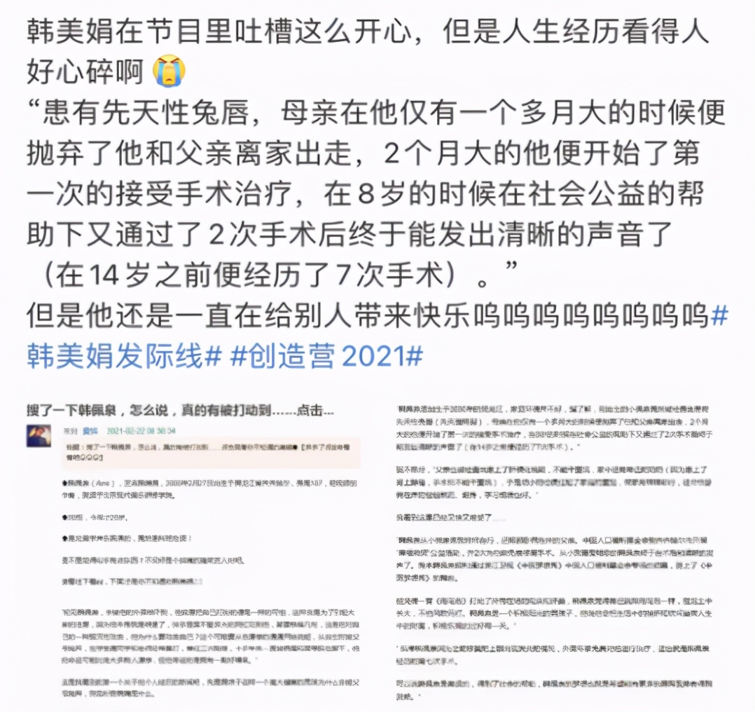 韩美娟摘掉假发套，发际线吓坏众人：这个世界还有什么是真的？