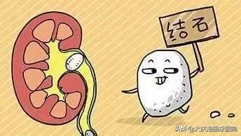 超大碎石怎么做，「3個(gè)月&40分鐘」粉碎4厘米腎結(jié)石