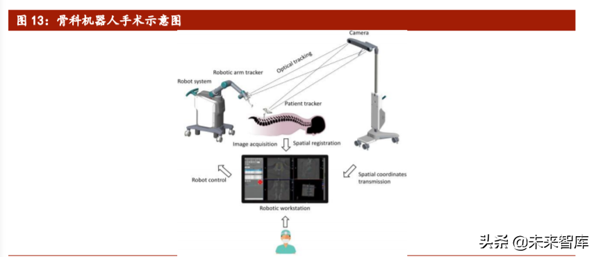 医疗机器人行业专题报告：骨科手术机器人迎来发展大时代