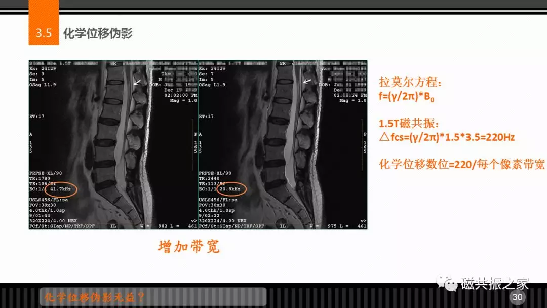 磁共振常见伪影及策略