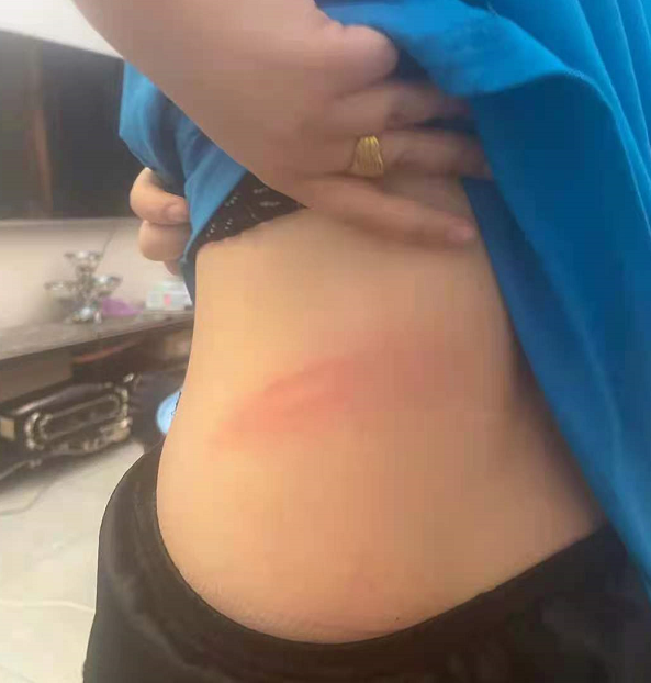 800万粉网红被控家暴，妻子晒多张照片肋骨被打断，孩子跪地求饶