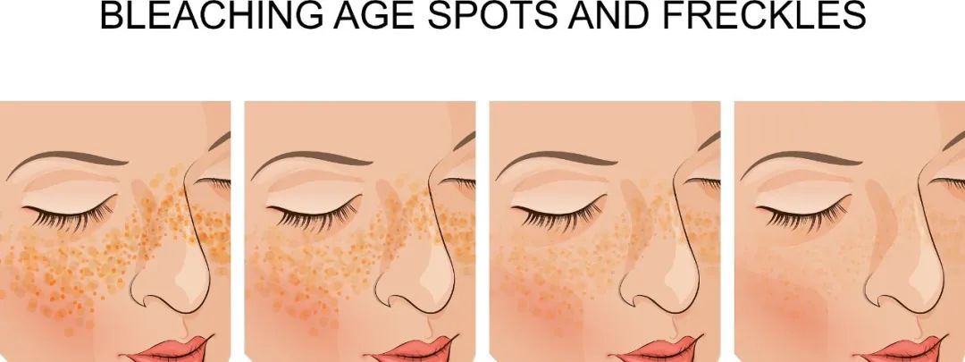 那些皮肤不长斑的人是怎么做到的？