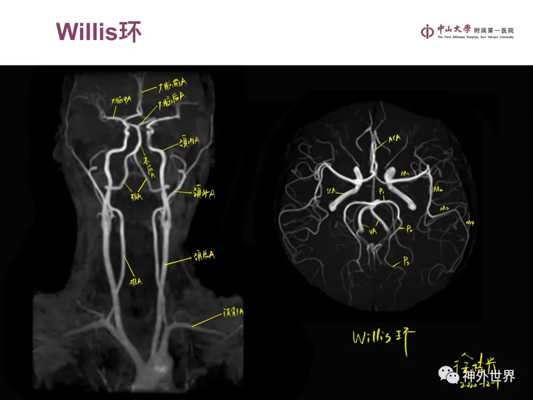 最全影像总结 | 颅内病变 MR、CT 的阅片技巧，太赞了