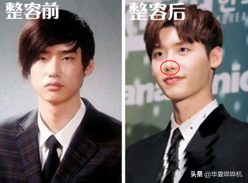 明星大型“翻车”现场，她们是如何整容变毁容