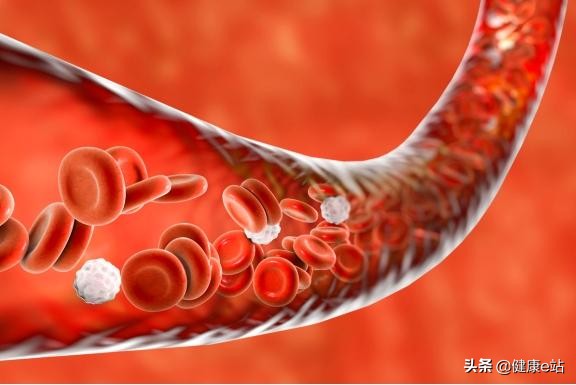 降血脂，及時預防是關鍵，5個“信號”提示你，血脂該控制一下了