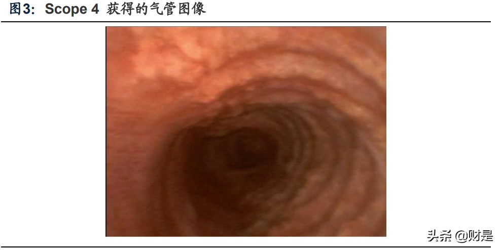 医疗器械之一次性内窥镜行业研究：化设备为耗材，行业空间大扩容