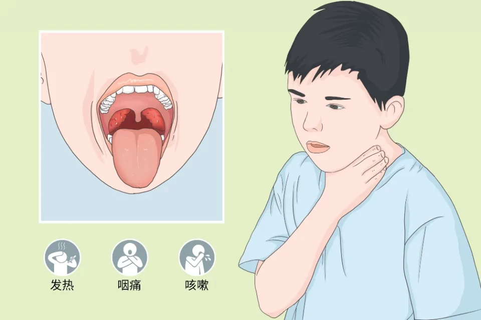 孩子突发高烧不吃东西直嚷喉咙痛许是患上这种上呼吸道疾病